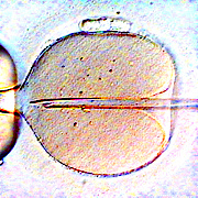 Foto einer In-vitro-Fertilisation