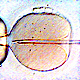 Foto einer In-vitro-Fertilisation